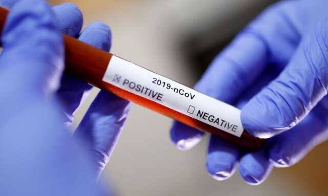 cientistas desenvolvem medicamento coronavirus