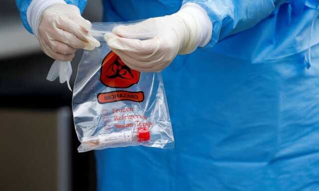 teste covid-19 coronavirus