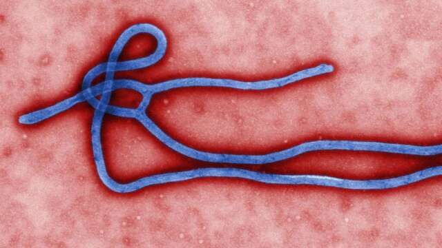 ebola virus