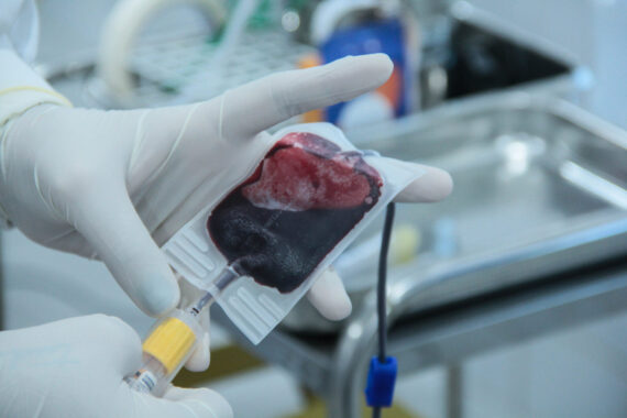 Ações de incentivo à doação de sangue são reforçadas pelo governo de RO durante as férias de julho Ações de incentivo à doação de sangue são reforçadas pelo governo de RO durante as férias de julho