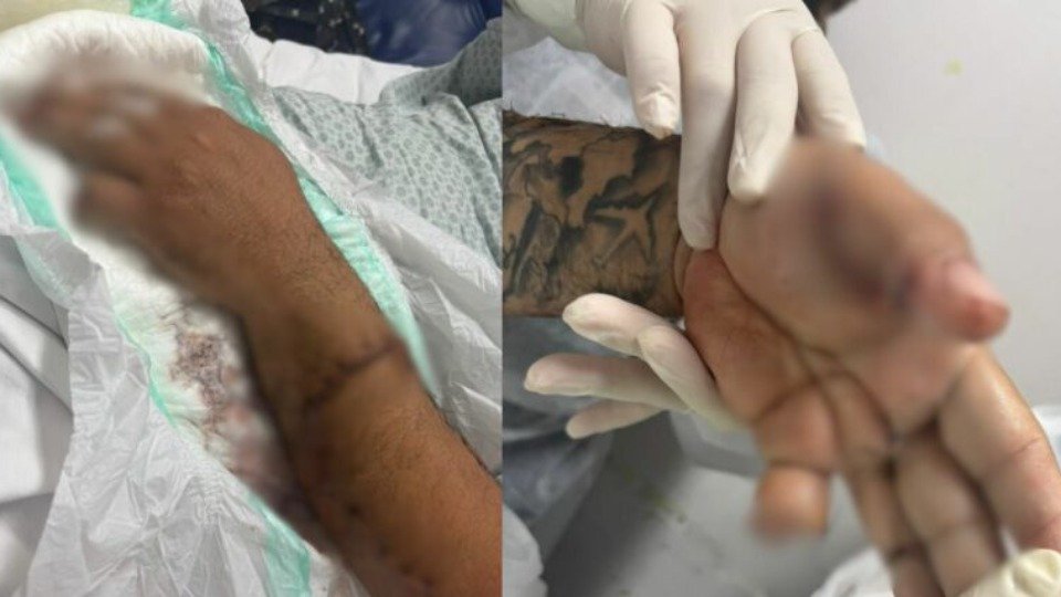 motorista-de-app-tem-dedo-amputado-apos-ataque-a-tercadadas motorista-de-app-tem-dedo-amputado-apos-ataque-a-tercadadas