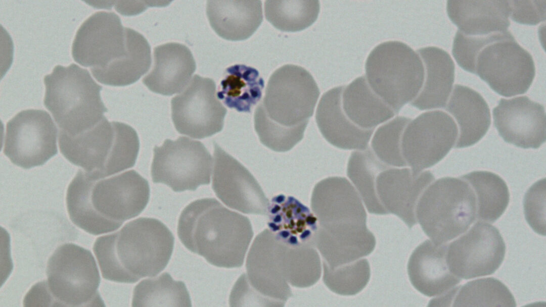 Imagem ao microscópio mostra esquizontes de Plasmodium vivax, fase de multiplicação dentro das células sanguíneas.  - malária