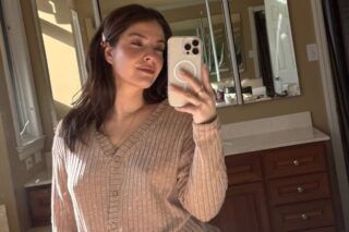 Atriz de ‘The Good Doctor’ revela ataque de cachorro