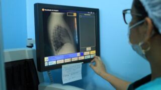 CUIDADOS – Prefeitura alerta para prevenção e tratamento da tuberculose