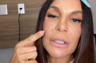 Ivete Sangalo revela uso de presilhas de titânio após cirurgia