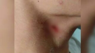 Jovem de 15 anos ataca colega com caneta