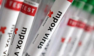 Sobe para 140 número de casos confirmados de Mpox no país, em 2026