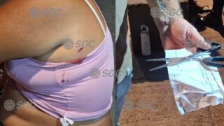 Mulher é ferida com tesoura por ciúmes